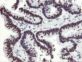 HOXC11 Antibody in Immunohistochemistry (Paraffin) (IHC (P))