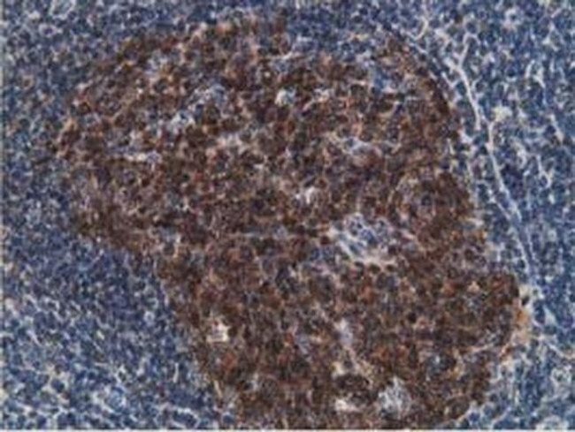 DCK Antibody in Immunohistochemistry (Paraffin) (IHC (P))