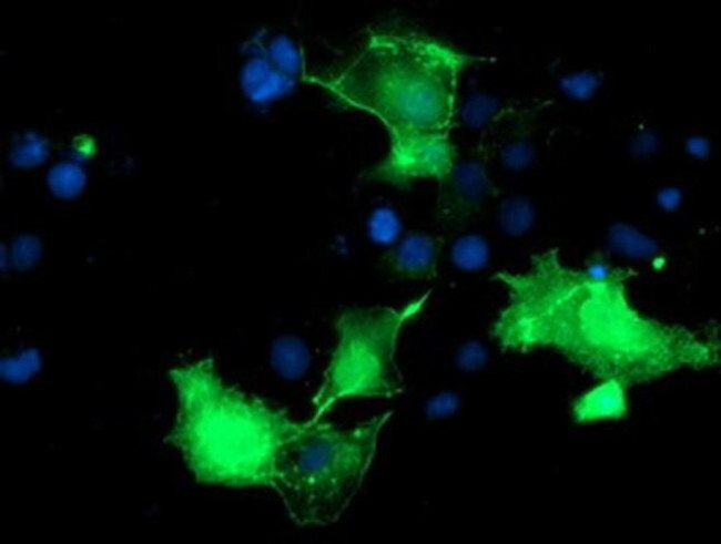 PDLIM2 Antibody in Immunocytochemistry (ICC/IF)