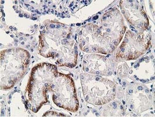 SSX1 Antibody in Immunohistochemistry (Paraffin) (IHC (P))