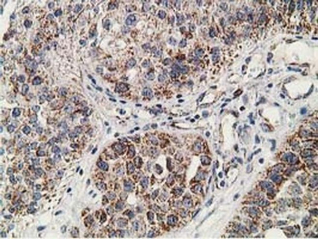 SSX1 Antibody in Immunohistochemistry (Paraffin) (IHC (P))