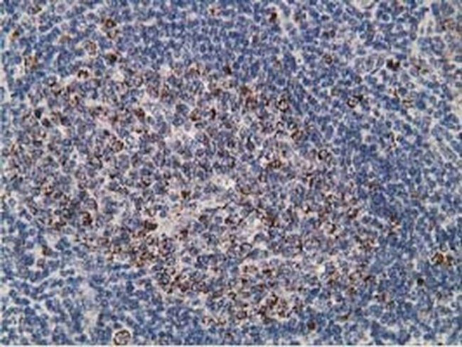 SSX1 Antibody in Immunohistochemistry (Paraffin) (IHC (P))