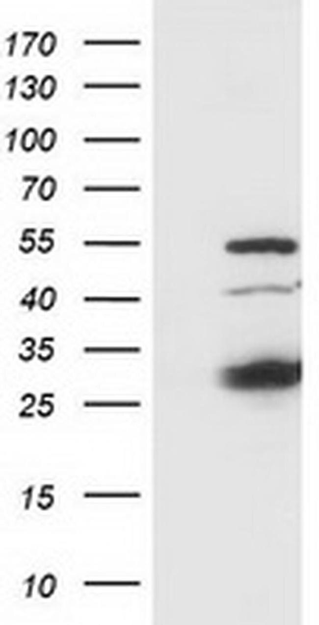 SSX1 Antibody in Western Blot (WB)