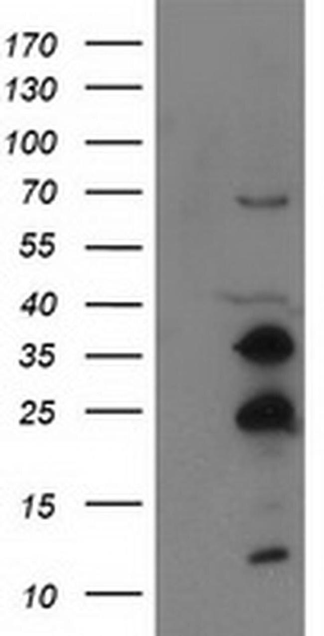 SSX1 Antibody in Western Blot (WB)