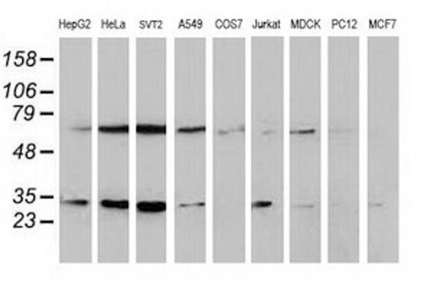 SSX1 Antibody in Western Blot (WB)