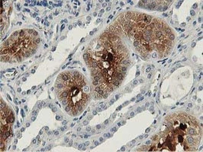 Aldolase B Antibody in Immunohistochemistry (Paraffin) (IHC (P))