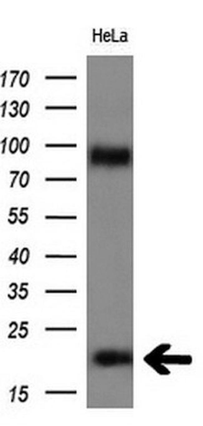 FGF21 Antibody in Western Blot (WB)