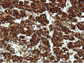 ILVBL Antibody in Immunohistochemistry (Paraffin) (IHC (P))