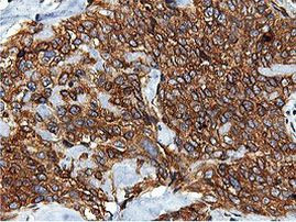 ILVBL Antibody in Immunohistochemistry (Paraffin) (IHC (P))