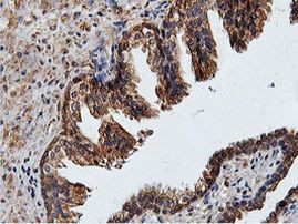 ILVBL Antibody in Immunohistochemistry (Paraffin) (IHC (P))