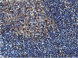 ILVBL Antibody in Immunohistochemistry (Paraffin) (IHC (P))