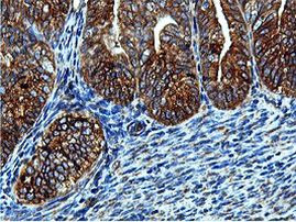 ILVBL Antibody in Immunohistochemistry (Paraffin) (IHC (P))