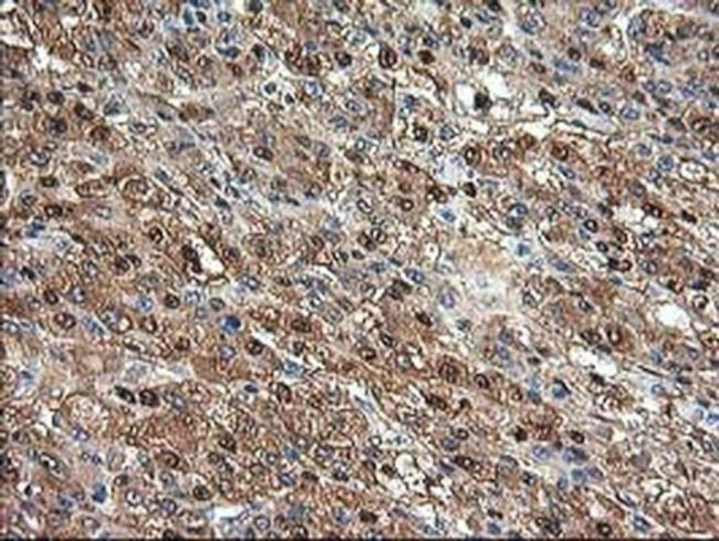 Aminoacylase Antibody in Immunohistochemistry (Paraffin) (IHC (P))