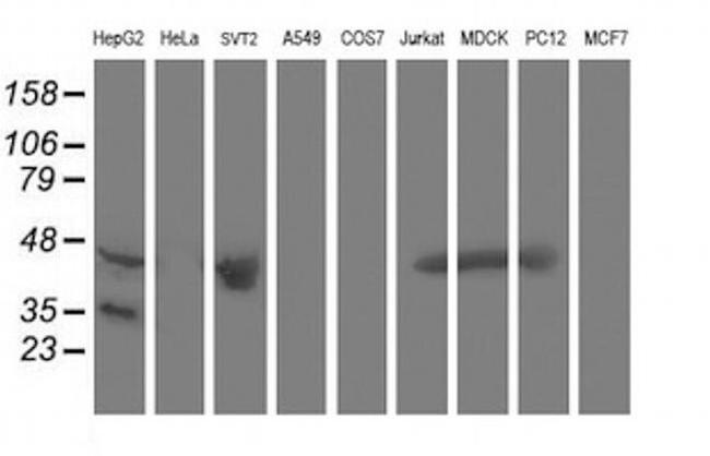 Aminoacylase Antibody in Western Blot (WB)