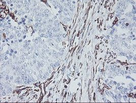 MCAK Antibody in Immunohistochemistry (Paraffin) (IHC (P))