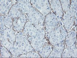 MCAK Antibody in Immunohistochemistry (Paraffin) (IHC (P))