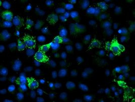 NUDT9 Antibody in Immunocytochemistry (ICC/IF)