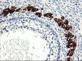 PTPN7 Antibody in Immunohistochemistry (Paraffin) (IHC (P))