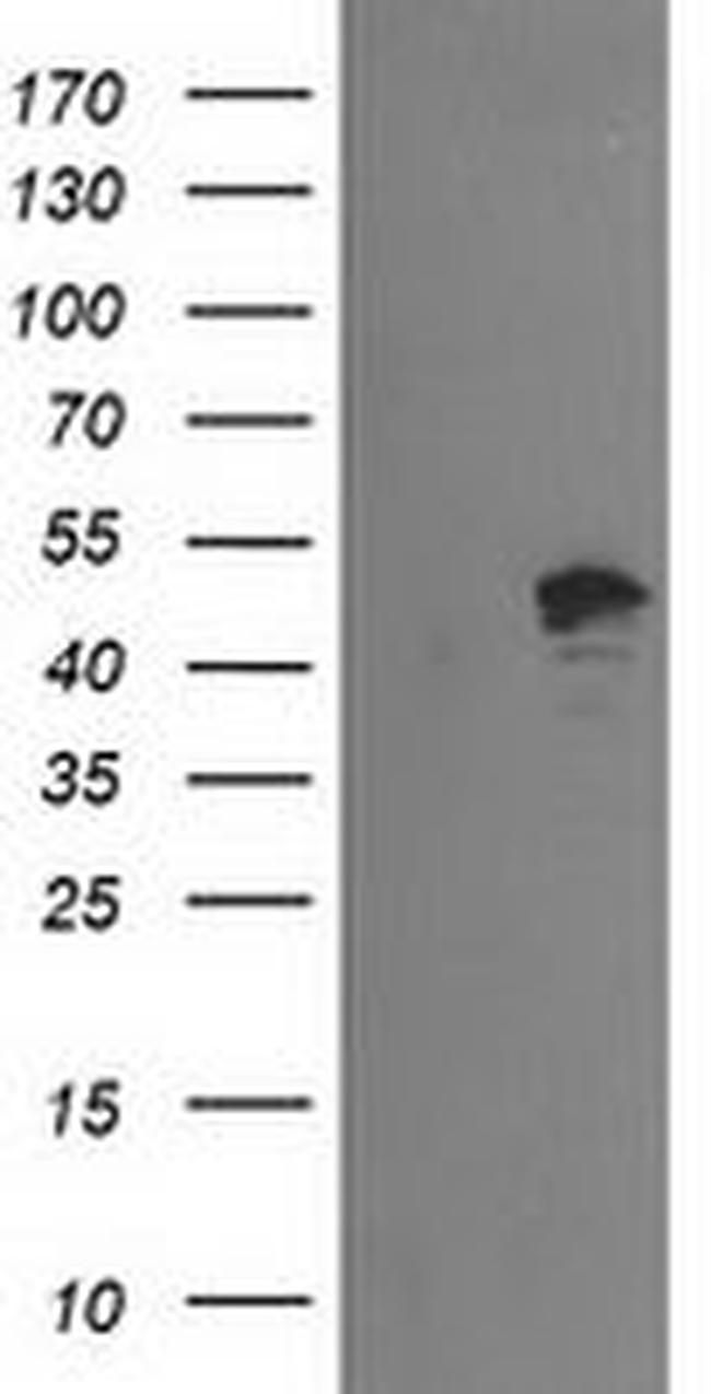 PTPN7 Antibody in Western Blot (WB)