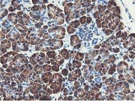 NUDT18 Antibody in Immunohistochemistry (Paraffin) (IHC (P))