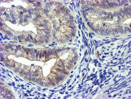 GSTO2 Antibody in Immunohistochemistry (Paraffin) (IHC (P))