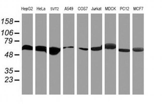 RNF113B Antibody in Western Blot (WB)