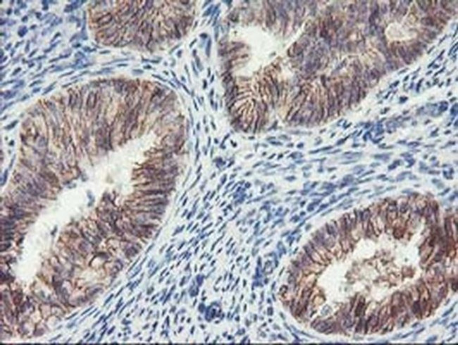 ALOX15 Antibody in Immunohistochemistry (Paraffin) (IHC (P))