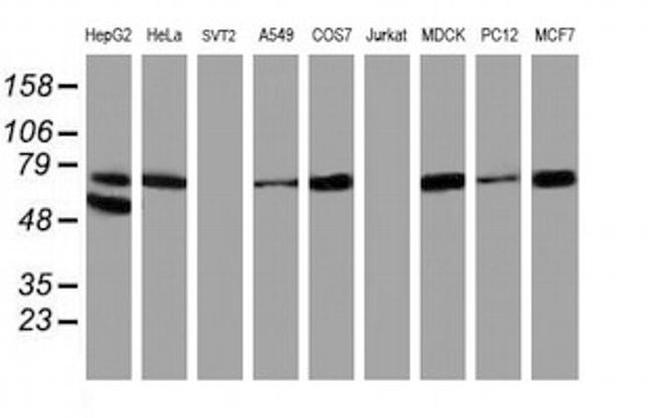 ALOX15 Antibody in Western Blot (WB)