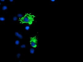 GADD34 Antibody in Immunocytochemistry (ICC/IF)