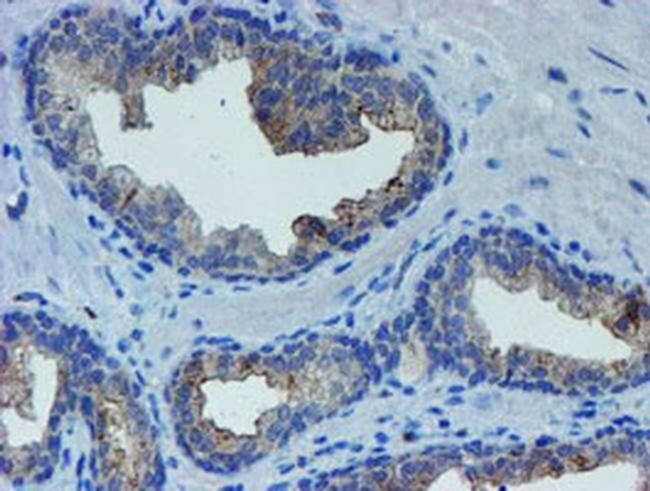 LIM1 Antibody in Immunohistochemistry (Paraffin) (IHC (P))