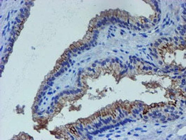 LIM1 Antibody in Immunohistochemistry (Paraffin) (IHC (P))