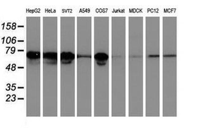 LRRC50 Antibody in Western Blot (WB)