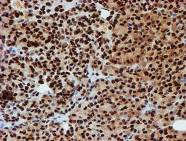 PADI4 Antibody in Immunohistochemistry (Paraffin) (IHC (P))