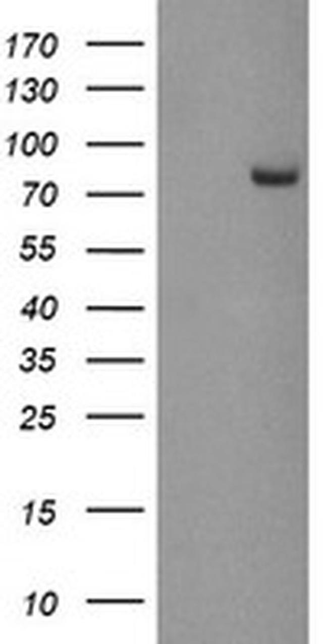 PADI4 Antibody in Western Blot (WB)