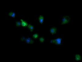 RIOK2 Antibody in Immunocytochemistry (ICC/IF)