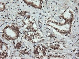 OTUB1 Antibody in Immunohistochemistry (Paraffin) (IHC (P))