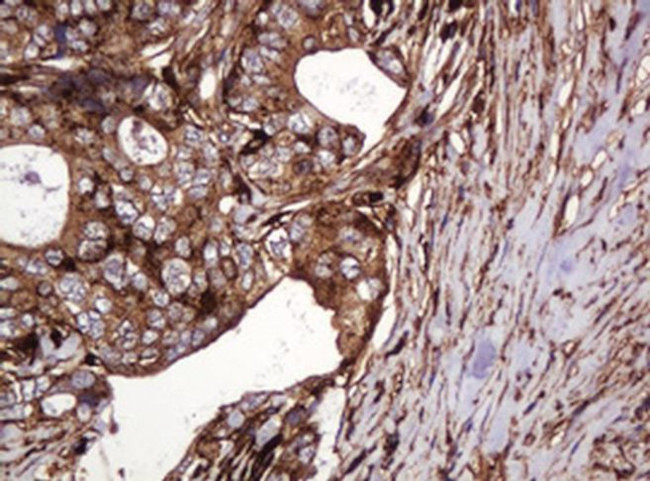 ATP6V1B2 Antibody in Immunohistochemistry (Paraffin) (IHC (P))