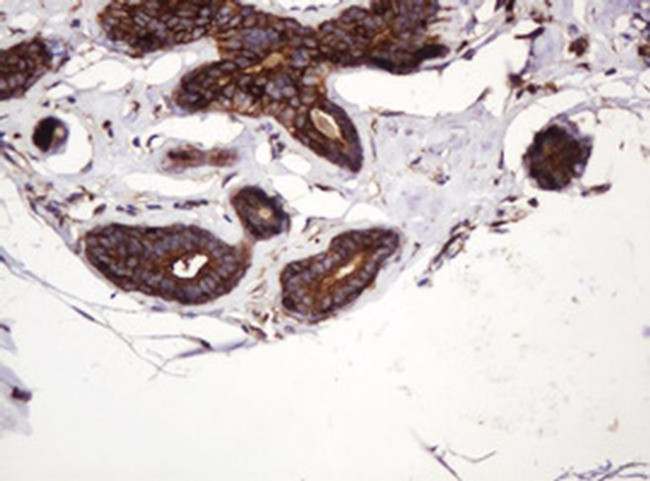 ATP6V1B2 Antibody in Immunohistochemistry (Paraffin) (IHC (P))