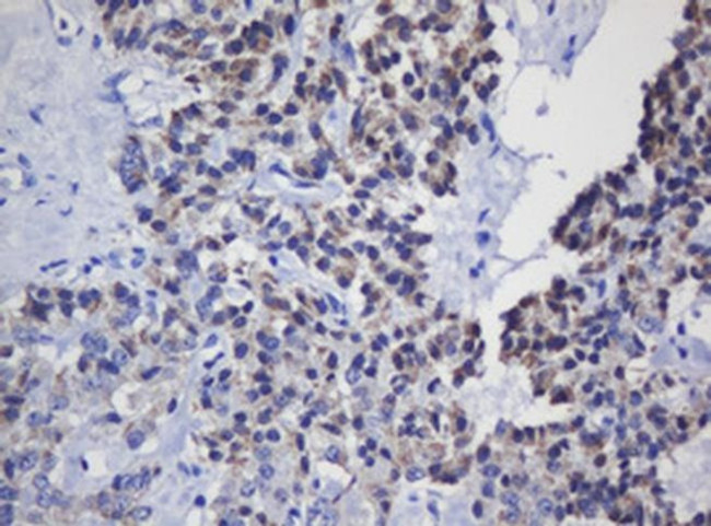 MRPL11 Antibody in Immunohistochemistry (Paraffin) (IHC (P))