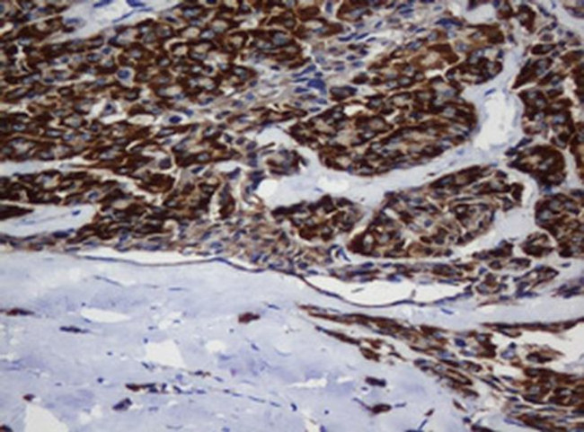 MRPL11 Antibody in Immunohistochemistry (Paraffin) (IHC (P))