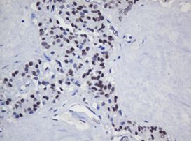 TRMT2A Antibody in Immunohistochemistry (Paraffin) (IHC (P))