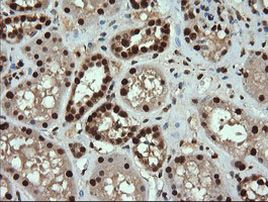 TRMT2A Antibody in Immunohistochemistry (Paraffin) (IHC (P))