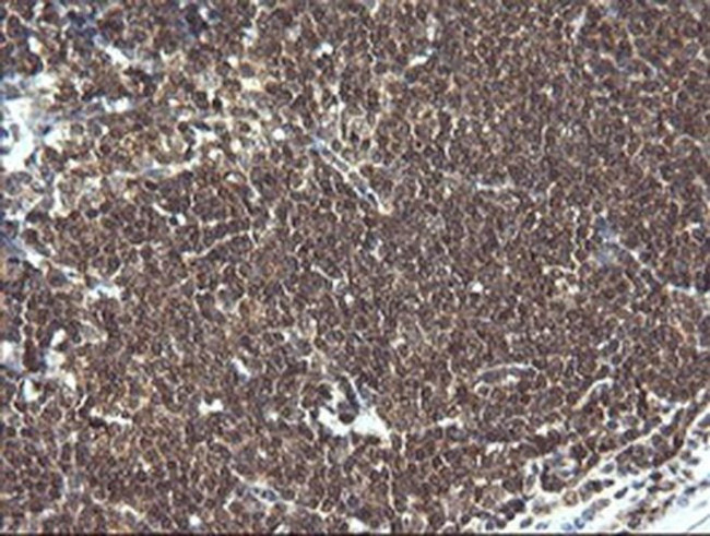 LZIC Antibody in Immunohistochemistry (Paraffin) (IHC (P))