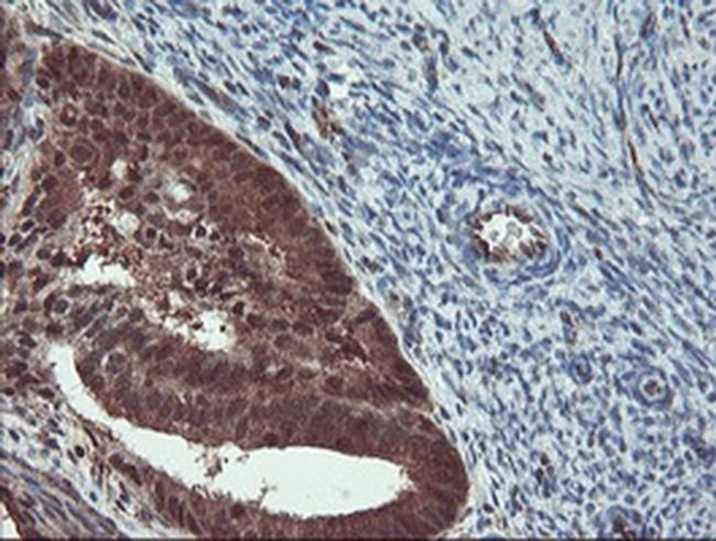 TRIP Antibody in Immunohistochemistry (Paraffin) (IHC (P))