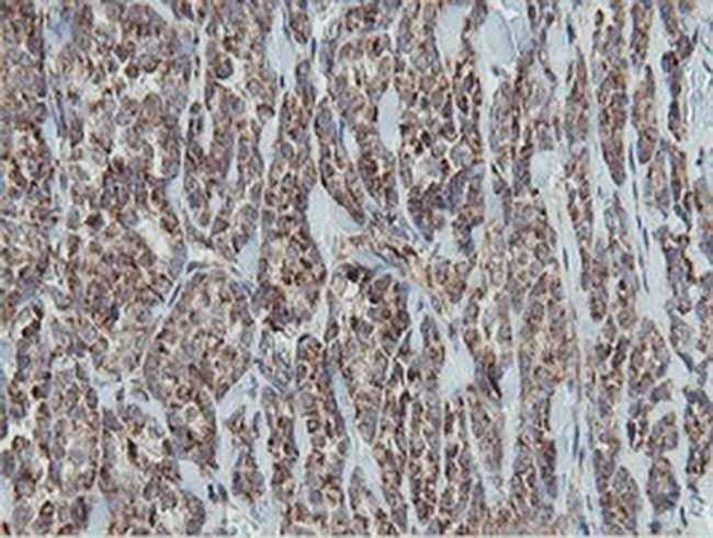 MRPS27 Antibody in Immunohistochemistry (Paraffin) (IHC (P))