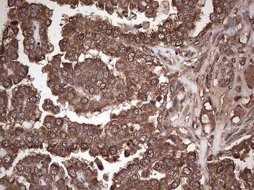 Dicer Antibody in Immunohistochemistry (Paraffin) (IHC (P))