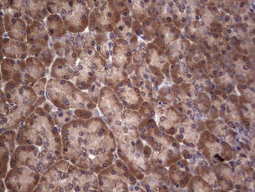 Dicer Antibody in Immunohistochemistry (Paraffin) (IHC (P))