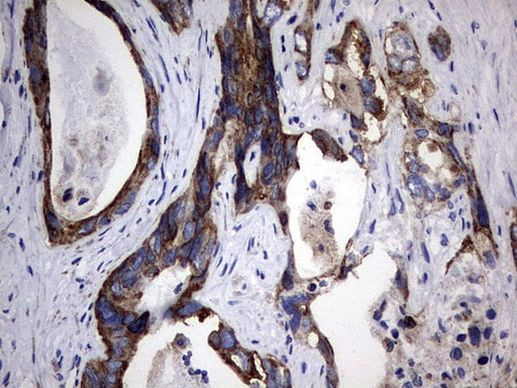 PIK3CD Antibody in Immunohistochemistry (Paraffin) (IHC (P))