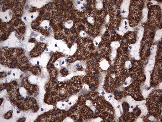 PIK3CD Antibody in Immunohistochemistry (Paraffin) (IHC (P))