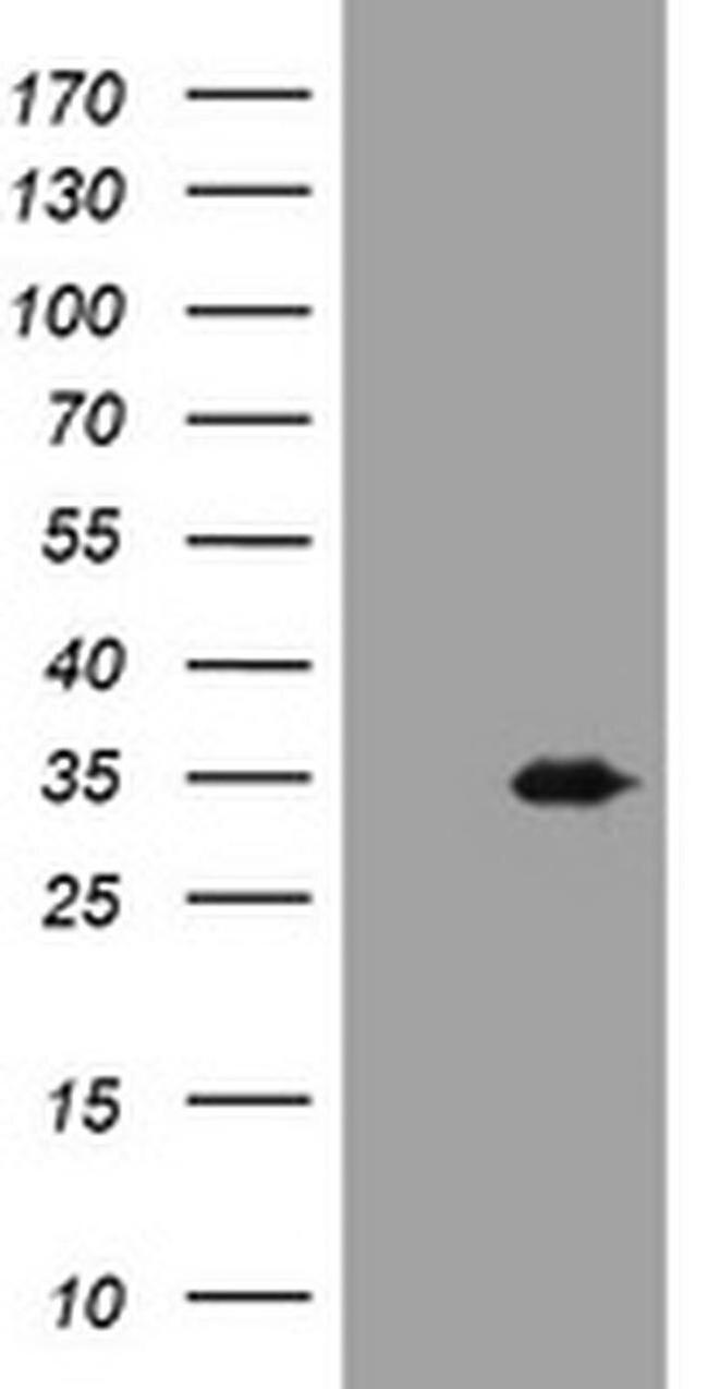 USP44 Antibody in Western Blot (WB)